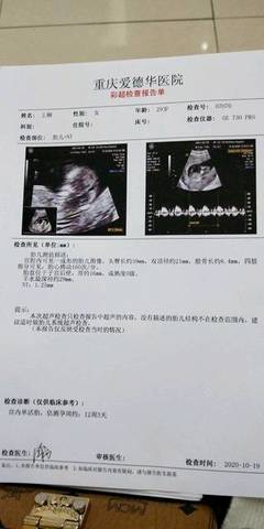 好奇问一下是男宝还是女宝?