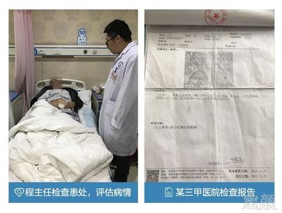 「康复案例」包茎引发癌症,因爱重获新生