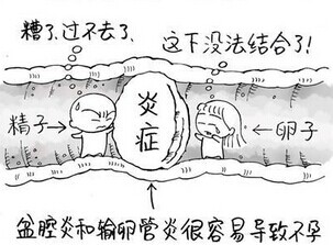 细解输卵管堵塞的症状有哪些组成的?