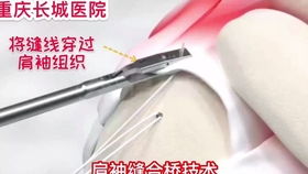 端午节重庆长城医院送粽子了