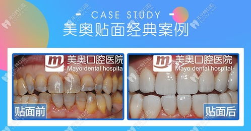 重庆口腔医院排名