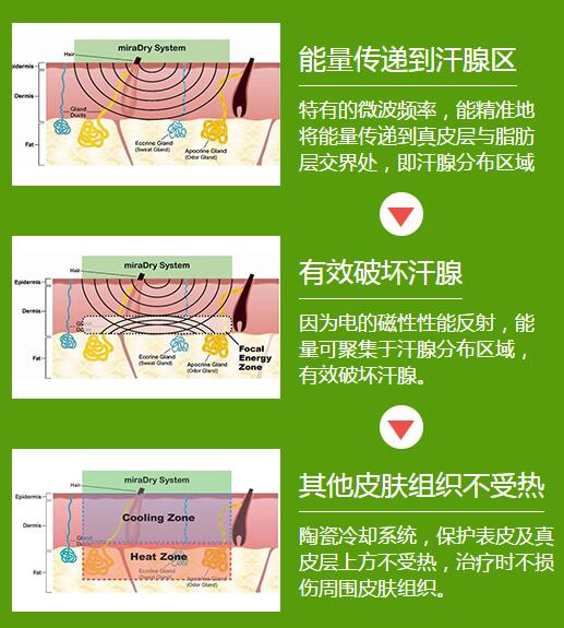 重庆爱德华医院 微创技术解决腋臭烦恼，告别手术痛苦